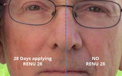 4 Tubes of RENU 28 - (80 ml / 2.7 FL OZ Skin Revitalizing Gel)