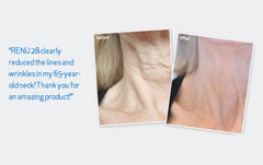 4 Tubes of RENU 28 - (80 ml / 2.7 FL OZ Skin Revitalizing Gel)