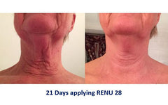 4 Tubes of RENU 28 - (80 ml / 2.7 FL OZ Skin Revitalizing Gel)