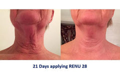 2 Tubes of RENU 28 - (80 ml / 2.7 FL OZ Skin Revitalizing Gel)