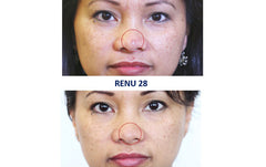 2 Tubes of RENU 28 - (80 ml / 2.7 FL OZ Skin Revitalizing Gel)